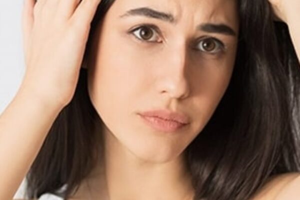 This one thing will control dandruff, and the method is easy